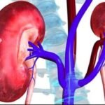 हाई ब्लड प्रेशर और शुगर बढ़ा सकते हैं किडनी रोग का खतरा, विशेषज्ञों ने दी चेतावनी